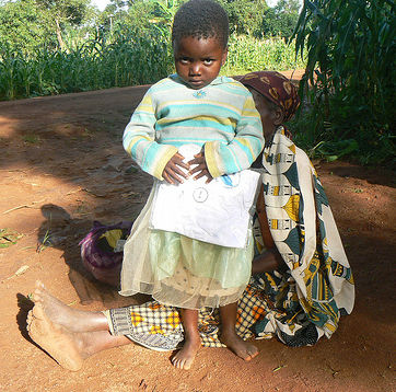 Chisomo Rodrick - Impact of AIDS in Africa